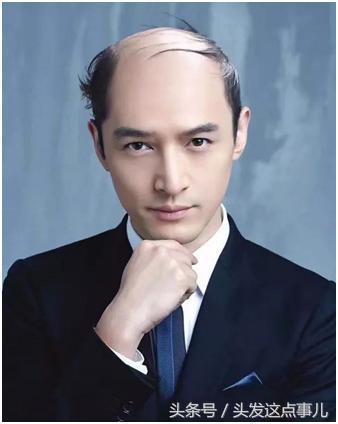 哪些明星是秃头